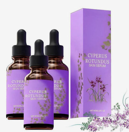 Serum Cyperus Rotundus – Reduce el Crecimiento del Vello | Natural y Sin Dolor