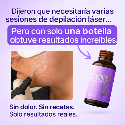 Serum Cyperus Rotundus – Reduce el Crecimiento del Vello | Natural y Sin Dolor